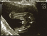 3rd Ultrasound 06